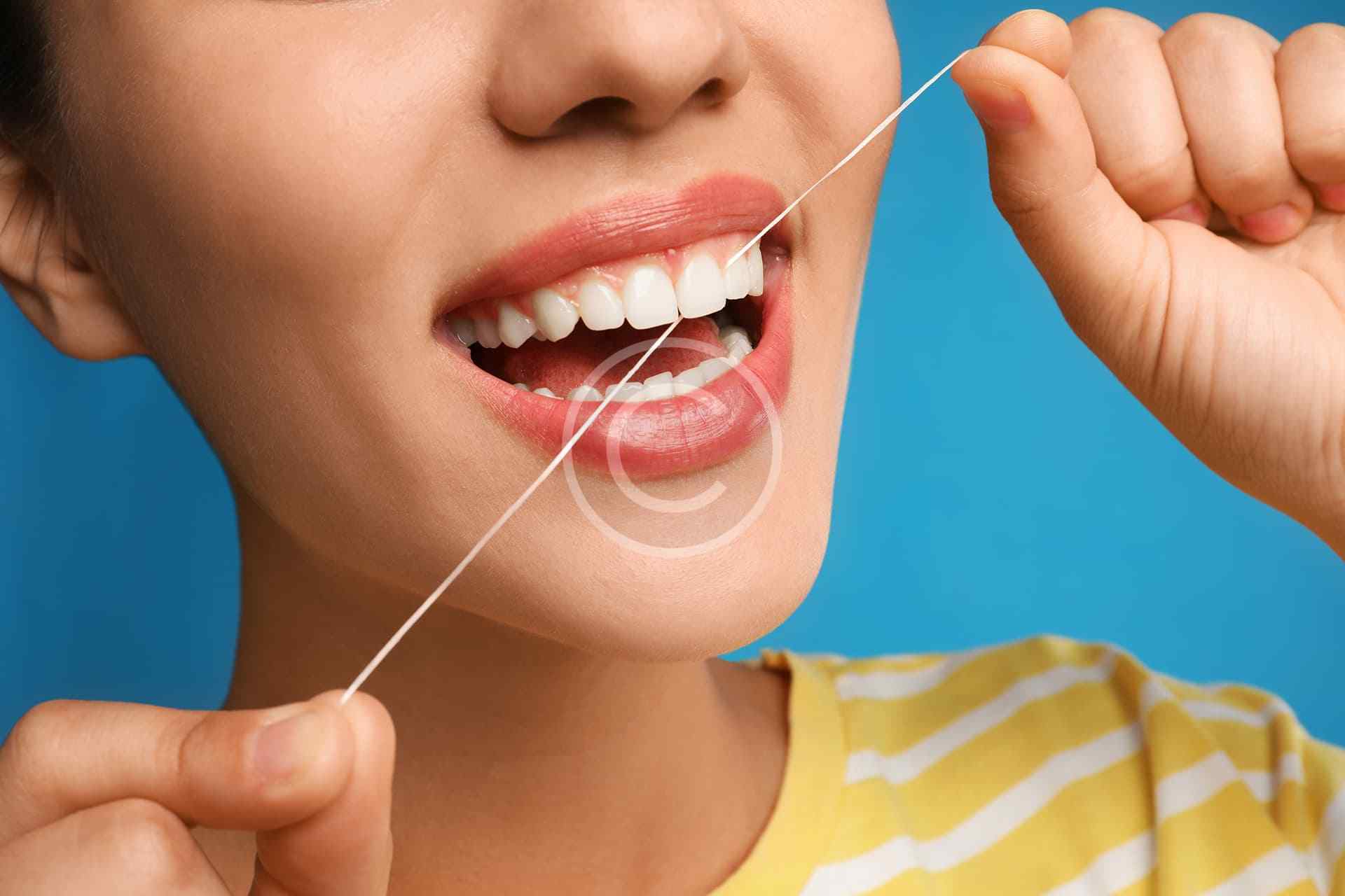 Dental veneers