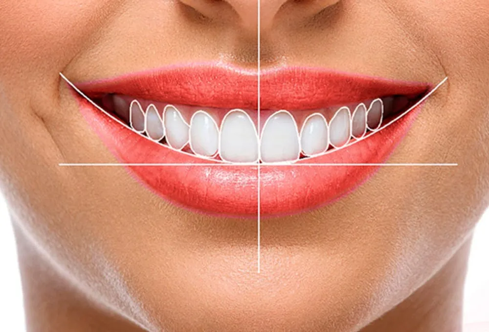 Estética Dental